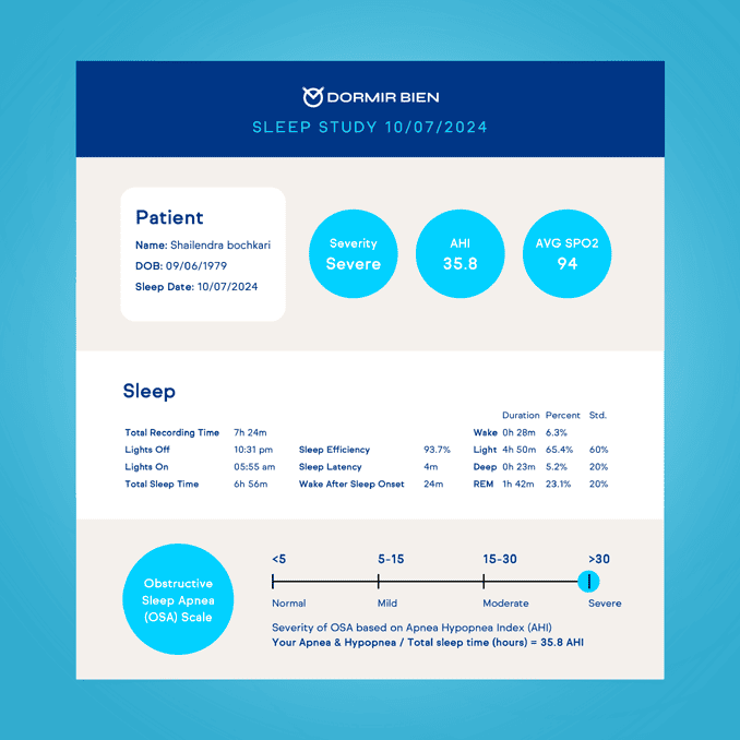 Fastnap Sleep Test